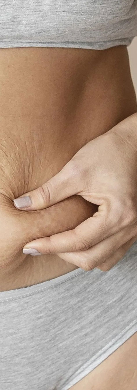 Detalle de hombro y espalda tras un tratamiento de regeneración cutánea